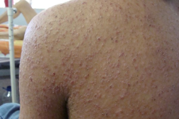 skin