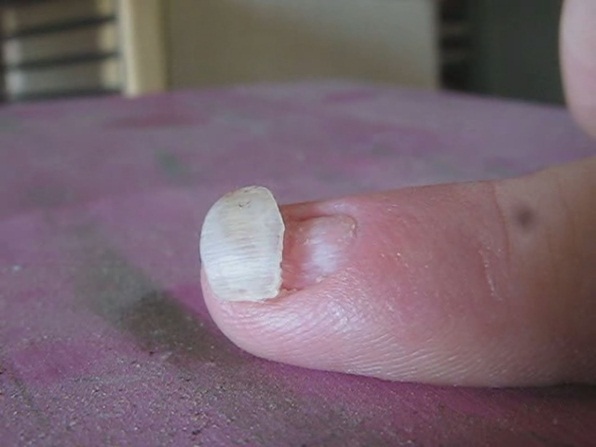 nail4