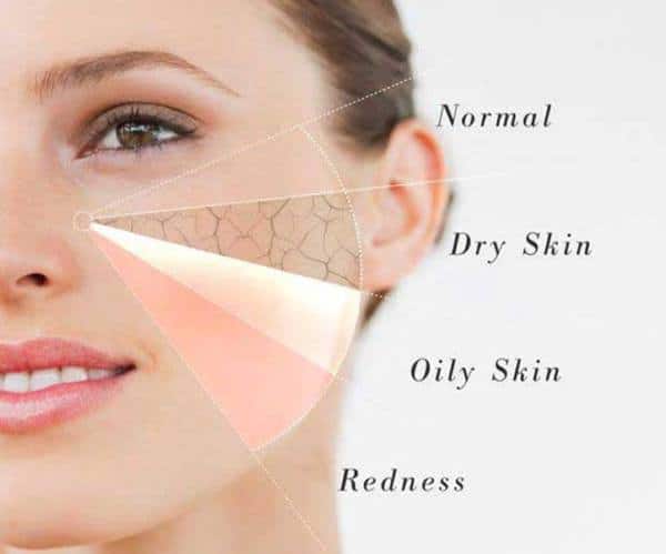 Types of Skin
