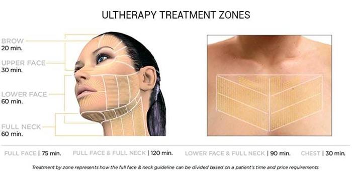 Ultherapy